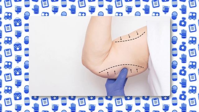 Подтяжка кожи рук – показания и особенности. Чем можно заменить брахиопластику? смотреть онлайн