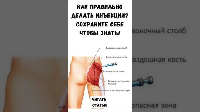 Как правильно делать инъекции? #здоровье #польза #рекамендация