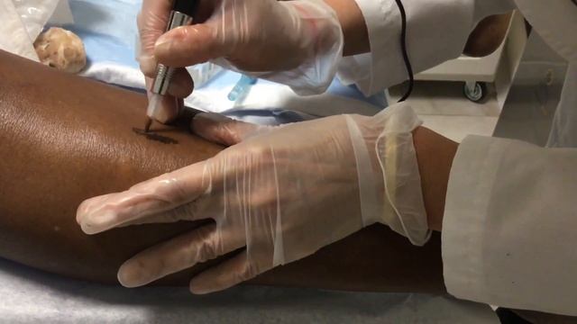 Skintology by Dr. Jennifer Walden NYC | Permanent Make-Up as Scar Camouflage / Micropigmentation смотреть онлайн