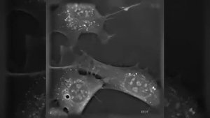 Процесс образования нейронных связей