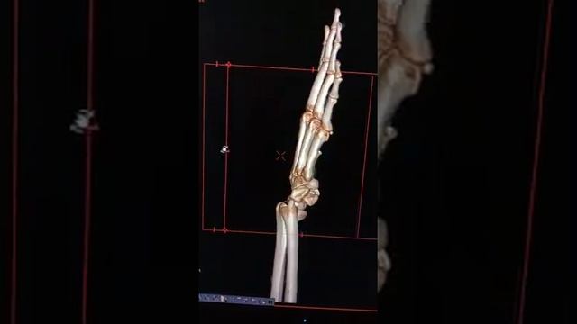 3D CT scan смотреть онлайн