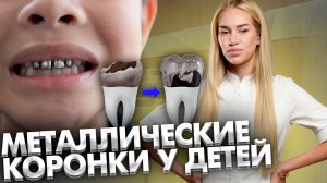 Металлические коронки на молочные зубы у детей, это не стресс для ребенка?