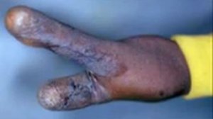 Мутации человека