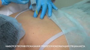 ОЗОНОТЕРАПИЯ