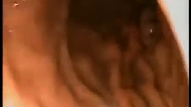 Путешествие по пищеварительной системе Wmv