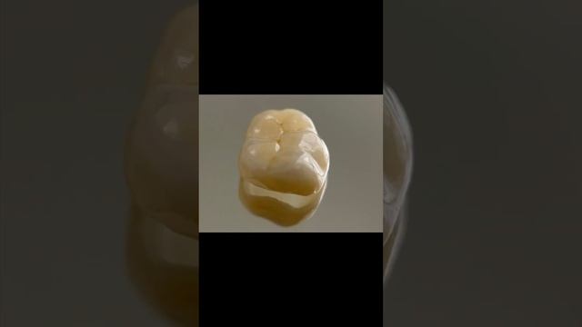 Коронка из оксида циркония (ZrO2). #3dstomatolog #цифроваястоматология #виниры