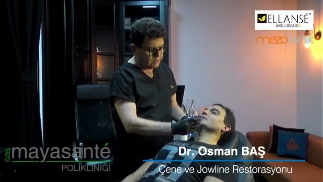 Ellanse Akıllı Dolgu Uygulama video Dr Osman Baş смотреть онлайн