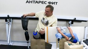 Некоторые способы крепления протеза ноги к культе.
