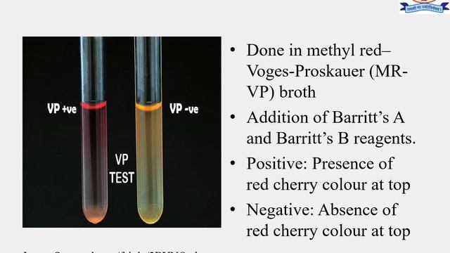 IMViC Test Final Video смотреть онлайн