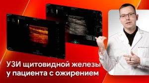 Сканирование щитовидной железы у пациента с ожирением на Mindray Resona i9