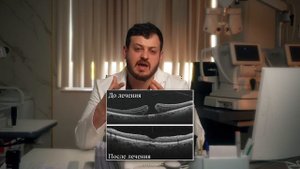 Макулярный разрыв  Как не потерять зрение