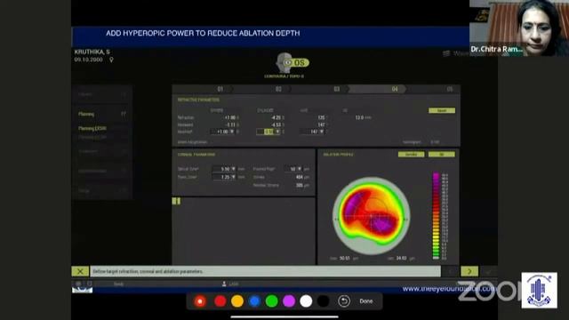 Dr Shreyas Ramamurthy - TOPOGUIDED PRK IN KERATOCONUS – WHEN AND HOW? смотреть онлайн