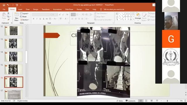 Genitourinary tuberculosis [GUTB]-Clinics for PG updates Season 2-[2020-2021] смотреть онлайн