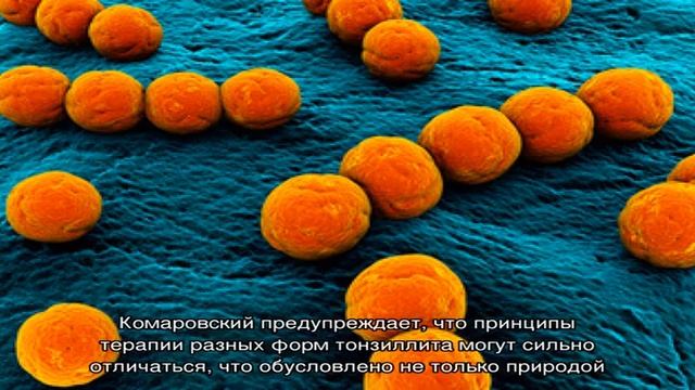 Принципы лечения ангины у детей по Комаровскому