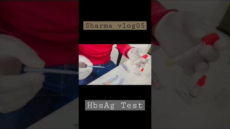 HbsAg Test 🔥 | #hepatitis #hbsag_treatment #shots