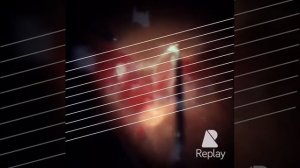 Витрэктомия при пролиферативной диабетической ретинопатии