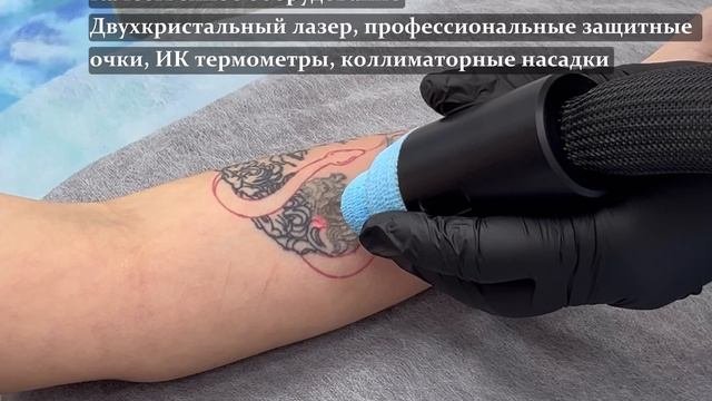 Обзор лазерного удаления