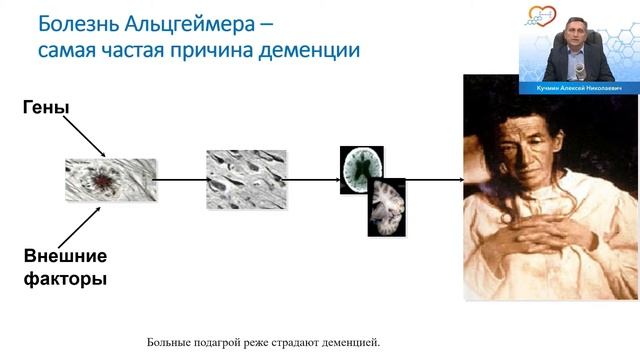 Коррекция гиперурекимии в лечении кардиологических пациентов. Современный взгляд на проблему
