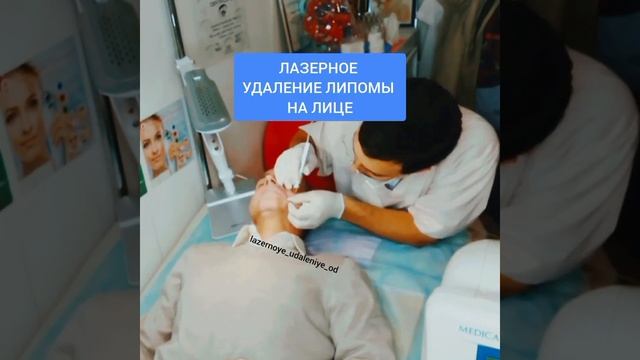 Лазерное удаление липомы