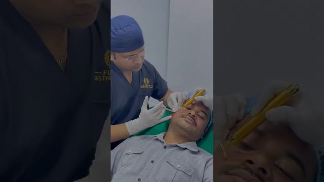 FACE PRP WITH MICRONEEDLING | Fusion Aesthetic Clinic | Dr. Pranil More смотреть онлайн