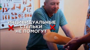 Индивидуальные стельки не помогают при плоскостопии, а лишь временно облегчают боль