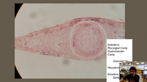 Week 3 Lab Recap: Cnidaria & Platyhelminthes