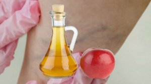 Варикозни уй шароитида даволаш усуллари