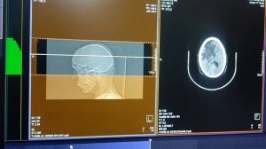 HOW TO DO CECT BRAIN IN 32 SLICE SIEMENS SOMATOM GO. NOW MACHINE #ctscan #brain