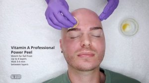 GlyMed Plus Vitamin A Chemical Peel Treatment | Australia