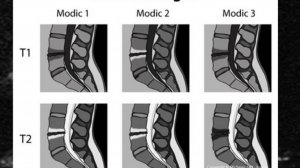 Что такое Modic?