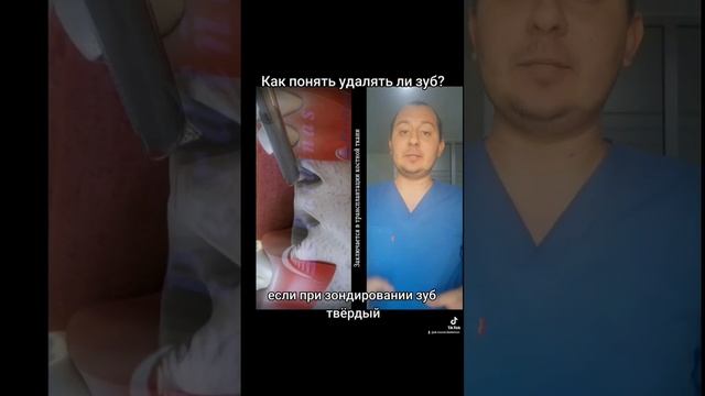 Удалять ли зуб? #стоматолог #стоматология #удалениезубовмудрости #удалениезубов #дантист #зубнойвра