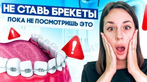 Что ОБЯЗАТЕЛЬНО нужно знать до УСТАНОВКИ БРЕКЕТОВ!