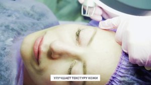 Лазерная блефаропластика