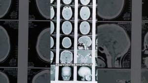 Как дыхание Пневма помогает расширить сознание