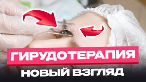 Зачем нужны пиявки? Гирудотерапия в косметологии и медицине