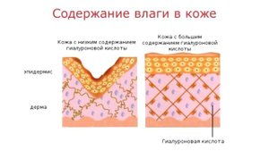 Би Лурон - Сохрани суставы живыми_к.м.н. Подхомутникова Ольга Валентиновна