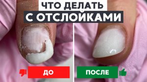 Отслойки на ногтях | Что делать? Почему появляются?  От снятия до топа | Выпиливать изнутри?