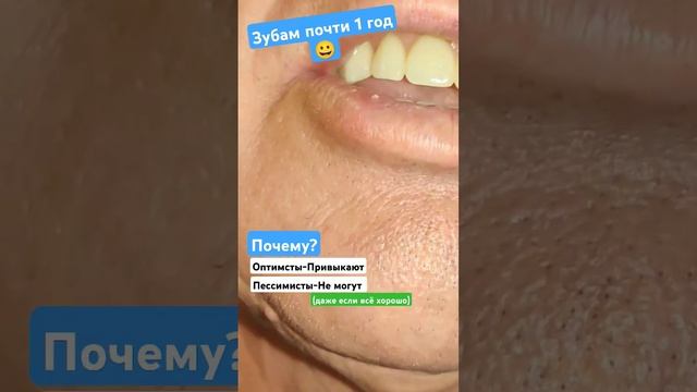 Полный Верх + Низ частичный. #безнёбасъёмныепротезы #зубныепротезы #съёмныепротезы