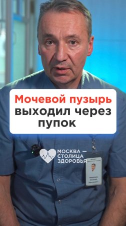 Мочевой пузырь 15 лет выходил наружу через пупок 😳 Трогательная история спасения девочки