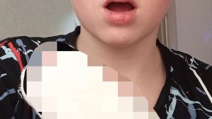 сломал палец🥵🥵🥵👆👆
