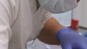 Примерка абатментов на импланты