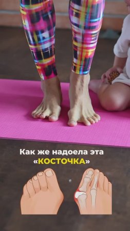 Скажи «привет» здоровым ногам: Упражнения против косточек на ногах! 🦶✨ Подписывайся ✅