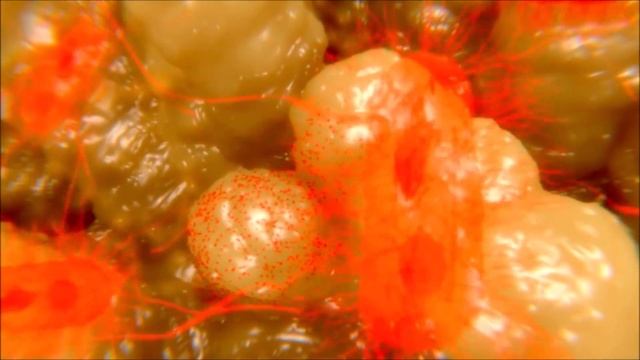 Crush UTI with D Mannose! смотреть онлайн