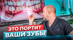 Какие продукты и привычки больше всего вредят зубам?