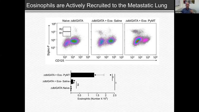 Eosinophils and Cancer - February 24, 2021 смотреть онлайн