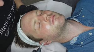 BB Glow Full Procedure | The Blush Lab