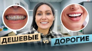 Сравнение дорогих и дешевых виниров! Какие виниры выбрать?