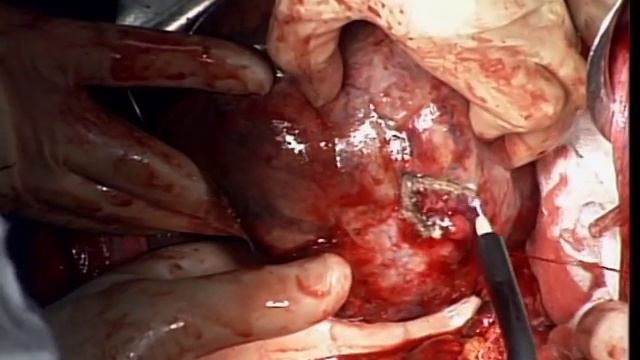 Левая латер 4 смотреть онлайн