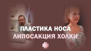 Как пластика носа и липосакция помогают в 50+: результат, который вдохновляет