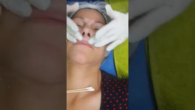 Microdermoabrasion Nuskin polishing peel смотреть онлайн